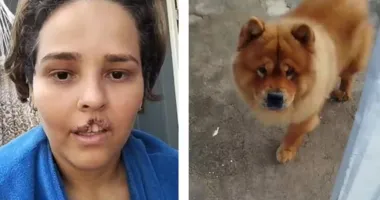 Imagem ilustrativa da imagem Homem manda matar cachorro após ataque que arrancou lábio da mulher