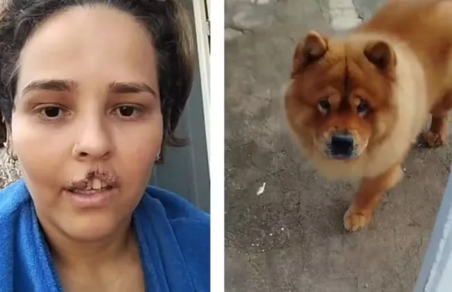 Imagem ilustrativa da imagem Homem manda matar cachorro após ataque que arrancou lábio da mulher