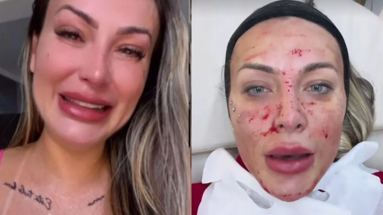 Urach mostrou o resultado no Instagram