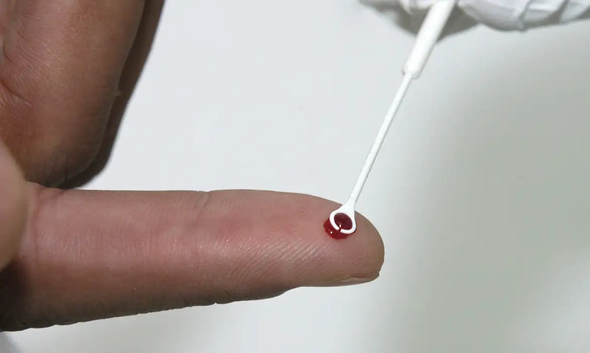Imagem ilustrativa da imagem Busca por remédio que previne HIV sobe 82,1% na Bahia
