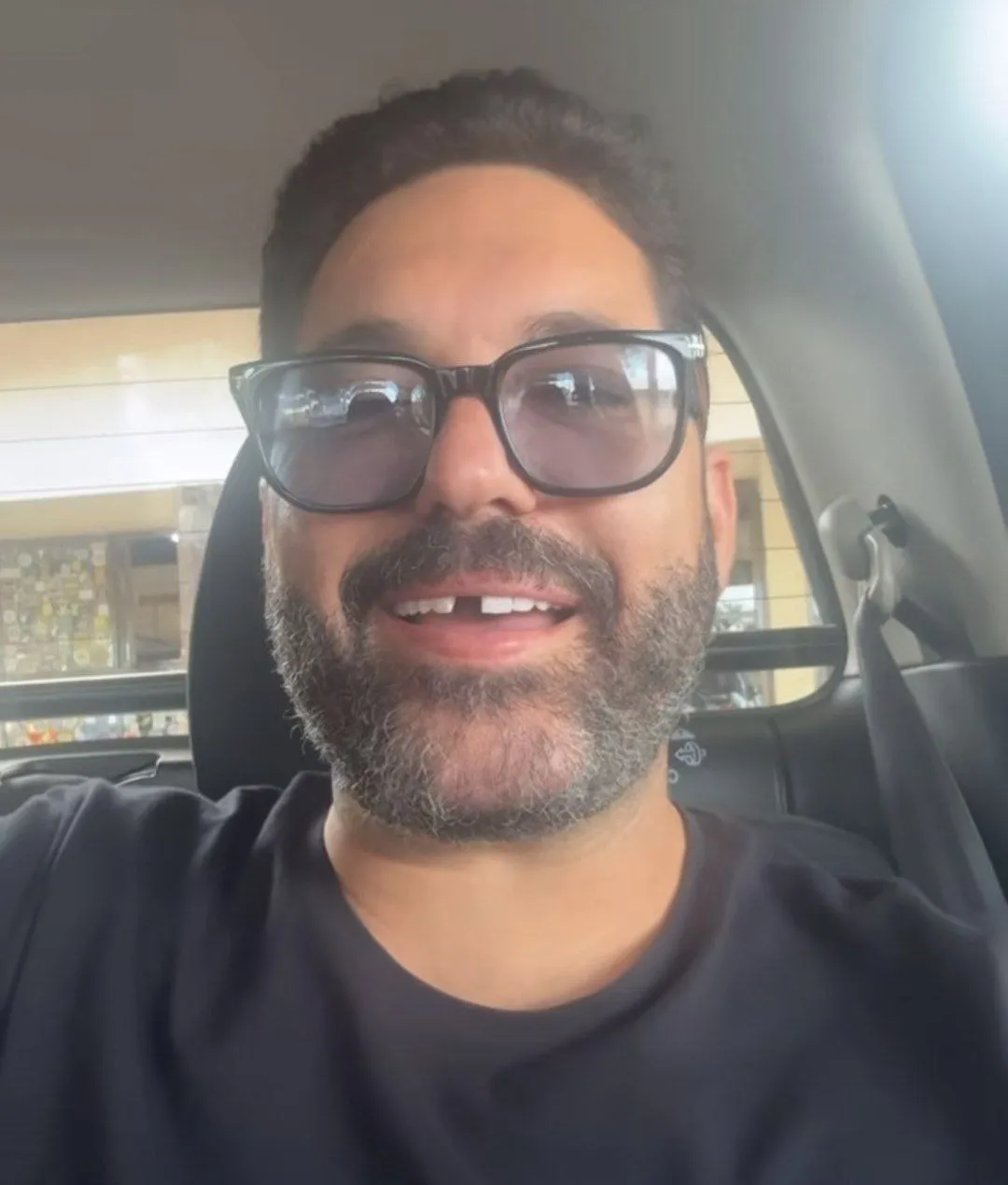 Imagem ilustrativa da imagem Cantor sertanejo famoso perde dente antes de show; confira
