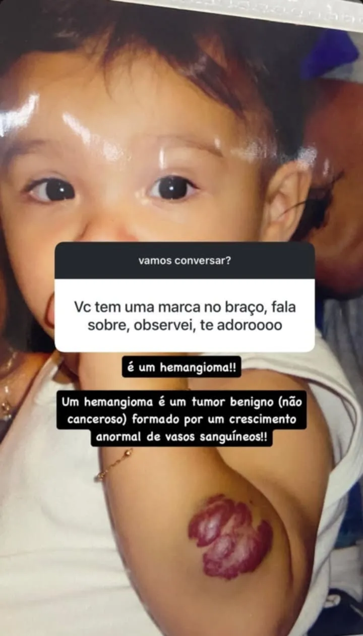 Tumor de Duda é benigno