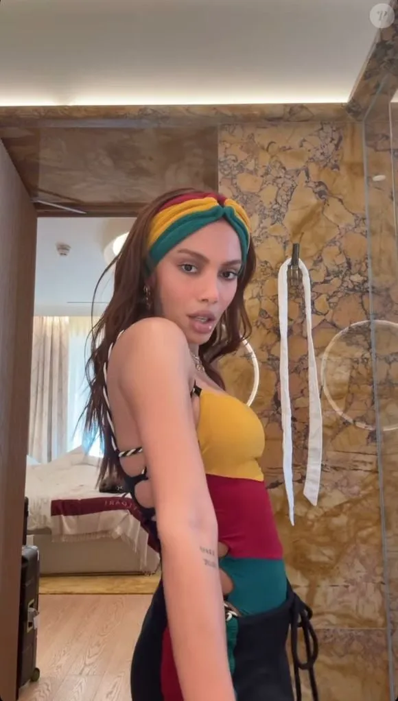 Imagem ilustrativa da imagem Veja 5 fotos do rosto de Anitta com procedimentos estéticos