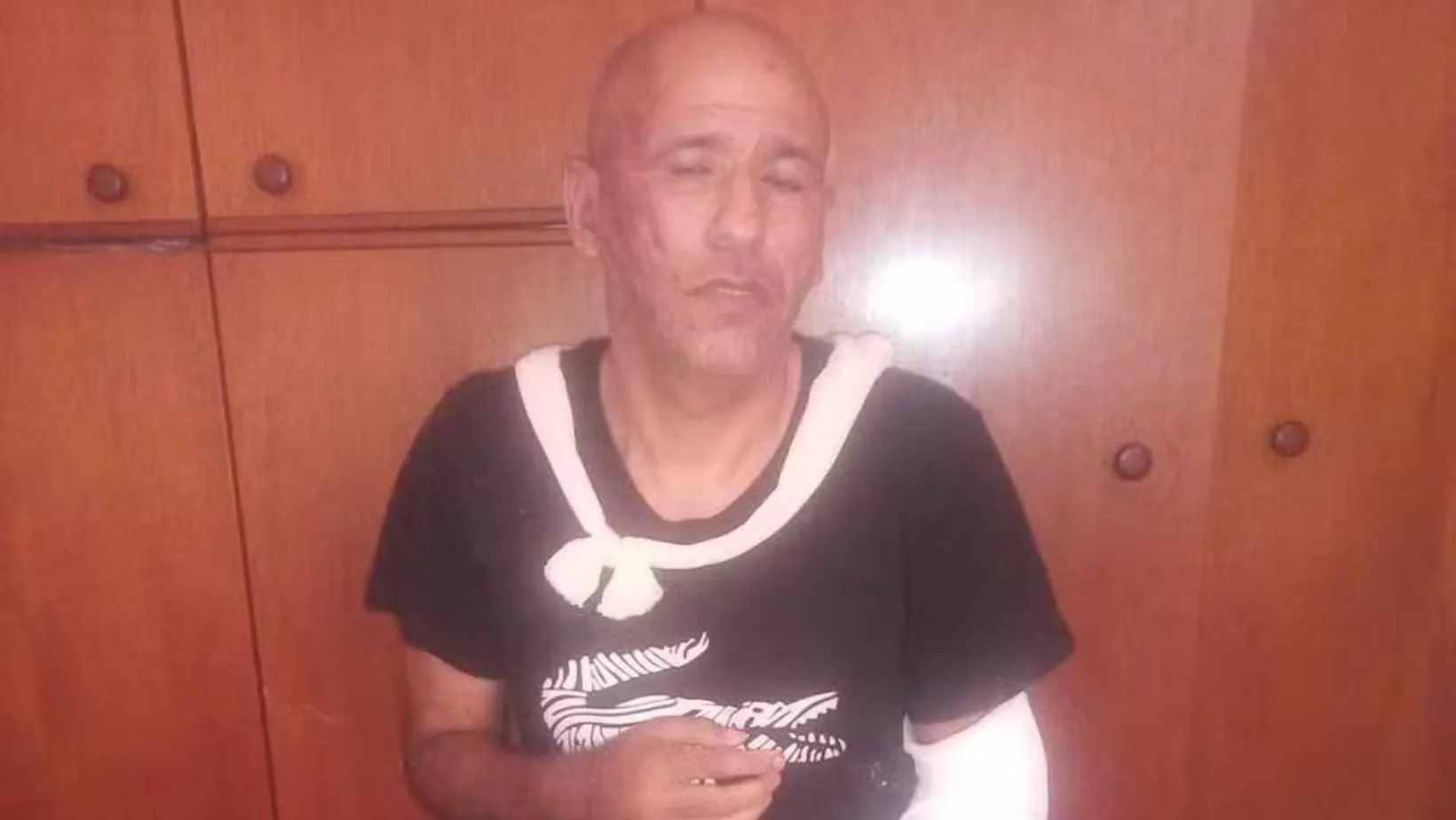 Renato Medeiros foi agredido e queimado