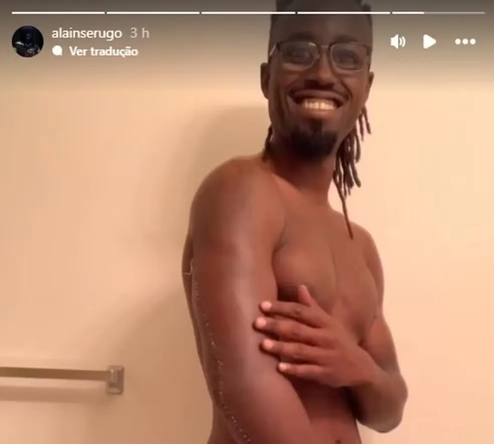 Alain Mbonerane mostra os pontos da cirurgia que precisou por conta da gravidade da lesão