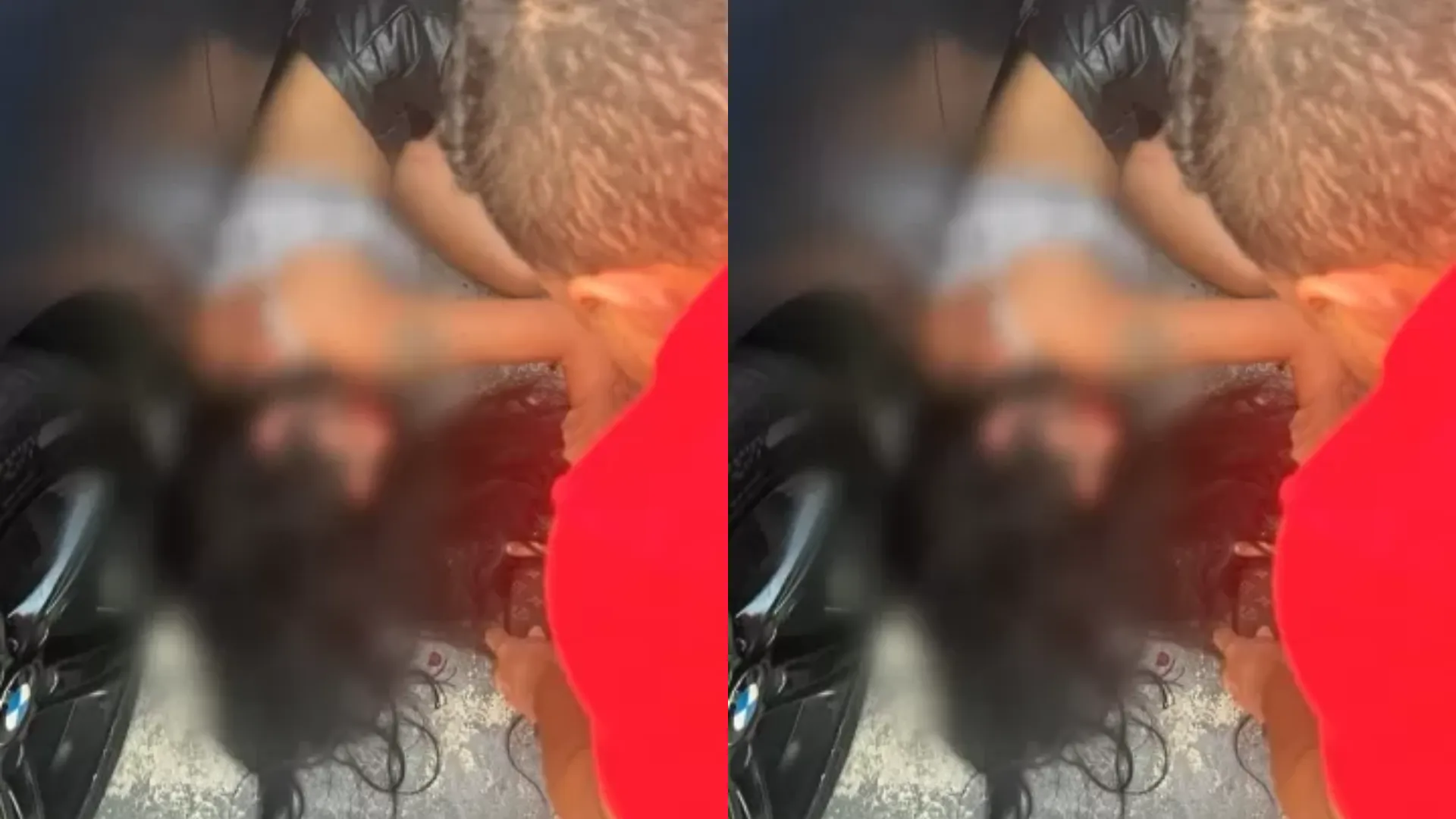 Milena Marinho após agressão