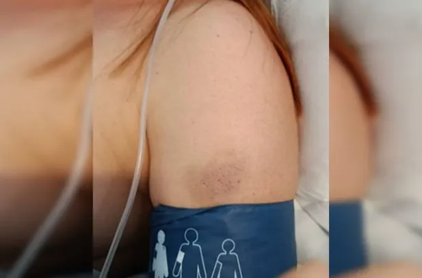 Imagem ilustrativa da imagem Mais uma! Vazam fotos de mulher agredida por marido em elevador