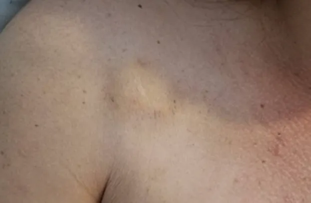 Imagem ilustrativa da imagem Mais uma! Vazam fotos de mulher agredida por marido em elevador