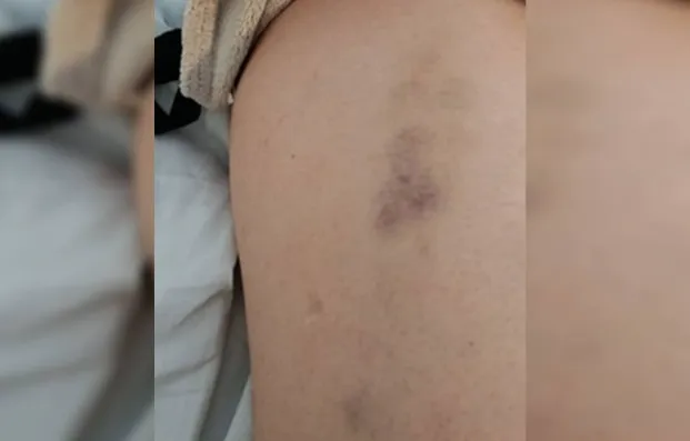 Imagem ilustrativa da imagem Mais uma! Vazam fotos de mulher agredida por marido em elevador