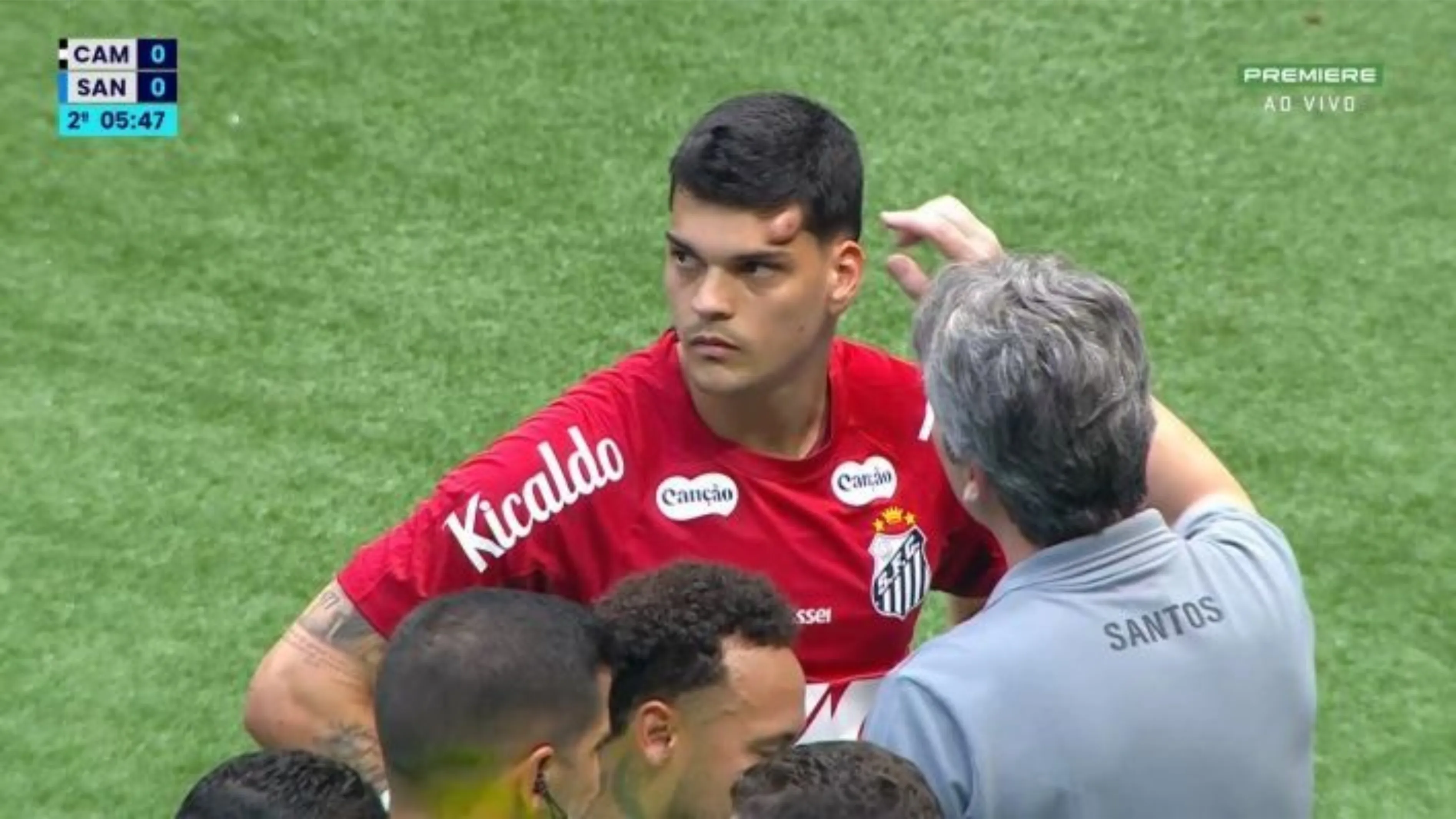 Arqueiro santista ficou com um hematoma enorme no rosto