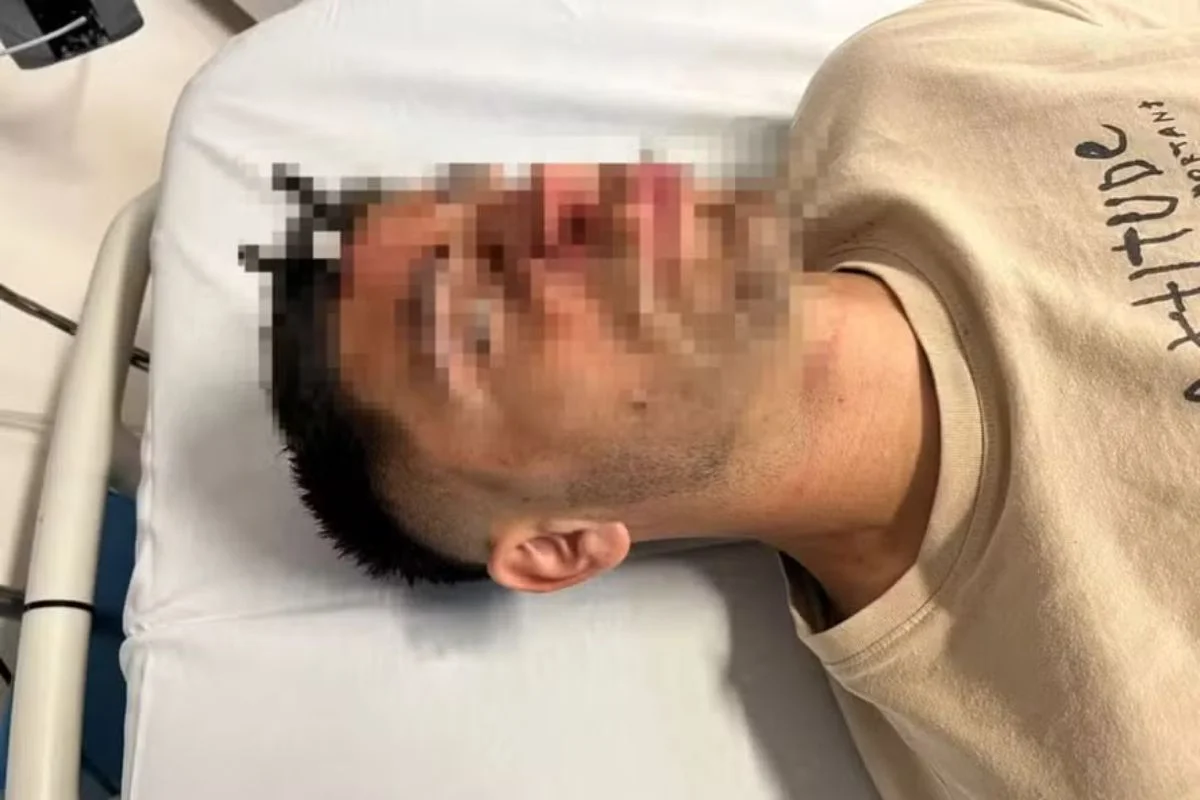 Jonathan Smith foi parar no hospital