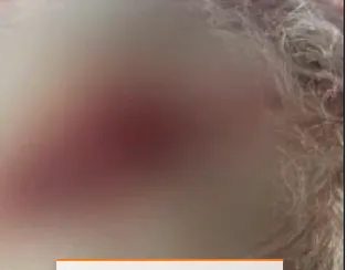 Condição da cabeça do cinegrafista