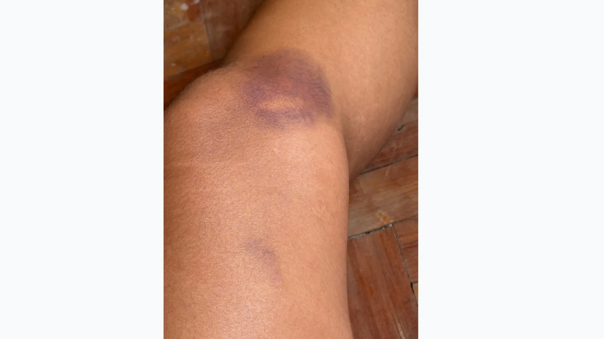 Imagem ilustrativa da imagem Defesa pessoal: blogueira que reagiu a assalto foi atrás de técnicas