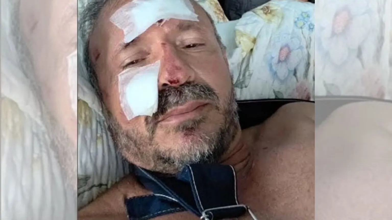 Choquinho teve escoreações pelo corpo