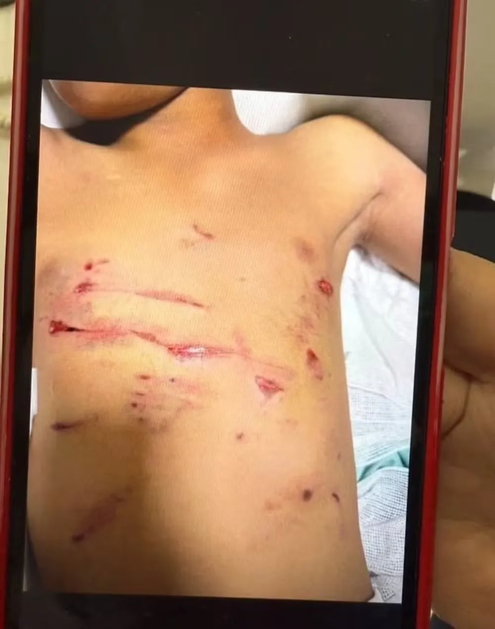 Garoto teve traumas físicos e mentais
