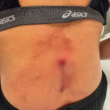 Tiro atingiu as costas da jogadora