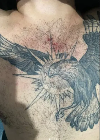 Músico mostrou marca da agressão sofrida no peito