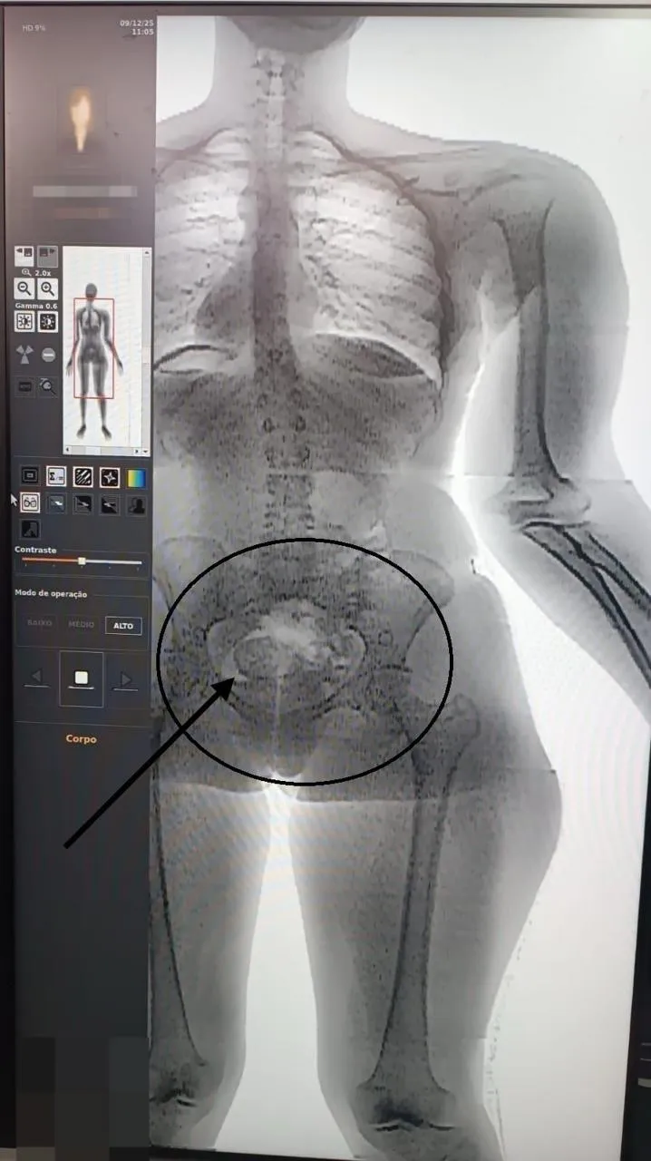 Droga estava nas partes íntimas da visitante