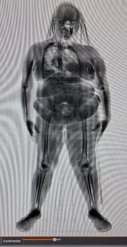 Imagens flagraram drogas nos corpos das mulheres