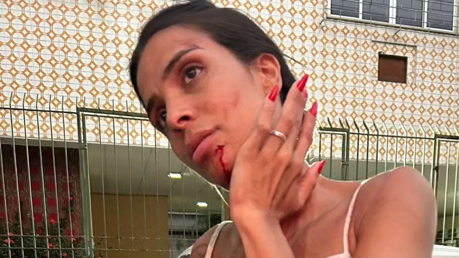 Karina aparece ensanguentada após confusão em bar