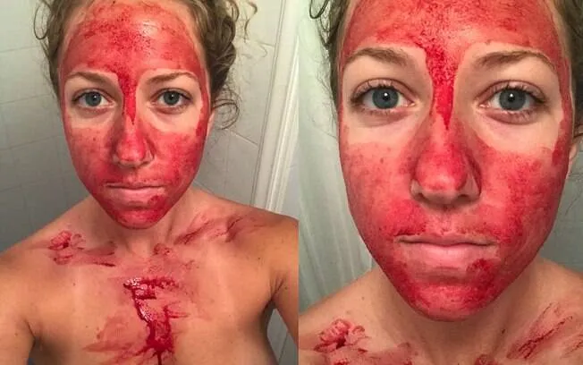 Imagem ilustrativa da imagem Sangue menstrual se transforma em ingrediente para tratamento de pele