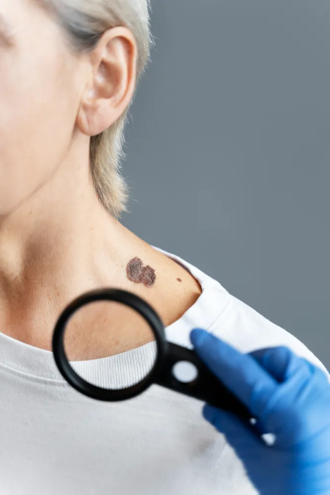 Cuidados com a pele devem acontecer o ano todo