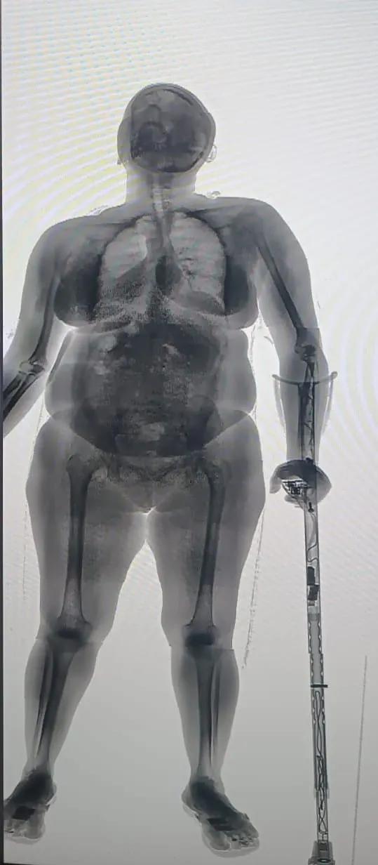 Idosa foi flagrada pela BodyScan