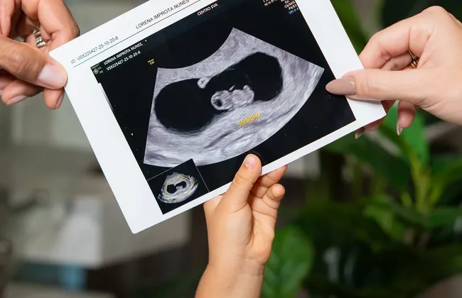 Imagem ilustrativa da imagem 