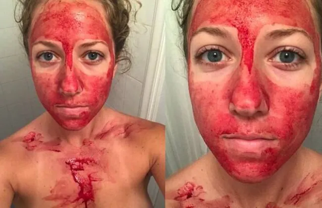 Imagem ilustrativa da imagem Sangue menstrual se transforma em ingrediente para tratamento de pele