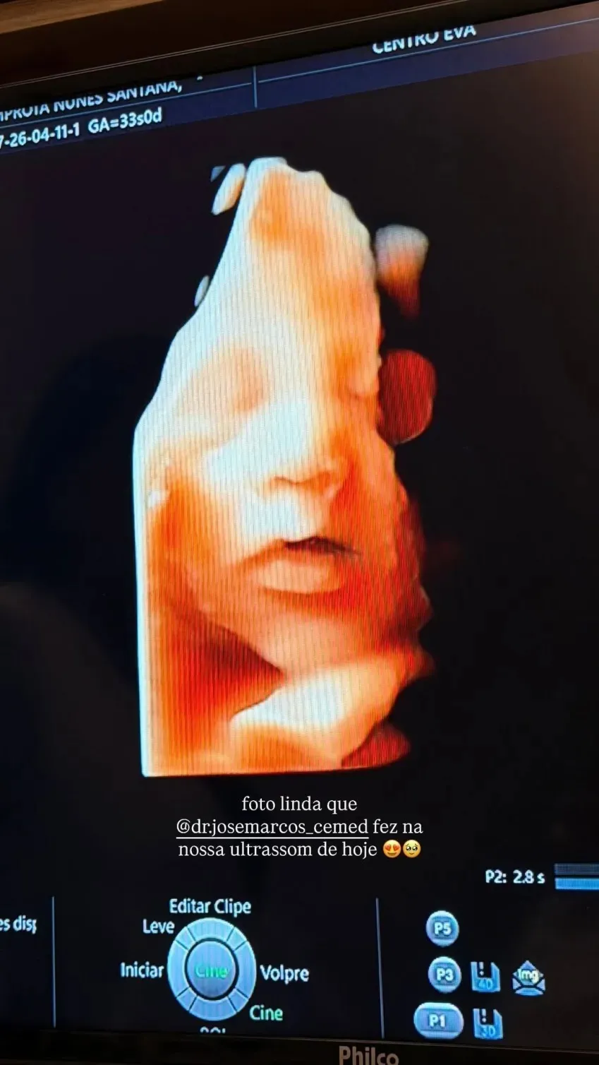 Imagem ilustrativa da imagem “A cara do pai”: Lore Improta revela ultrassom do segundo filho