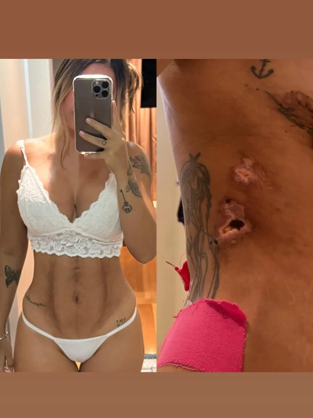 Influenciadora Mariana Tavares mostra corpo necrosado