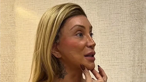 Maya Massafera afinou o queixo