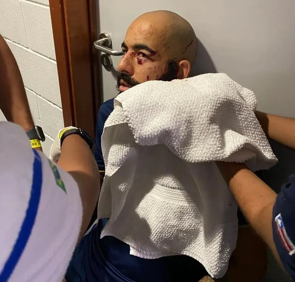 Danilo Fernandes sofre cortes no rosto em ataque a ônibus do Bahia