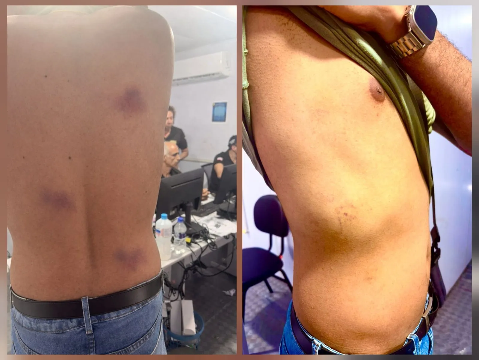 Homem foi agredido com cacetete