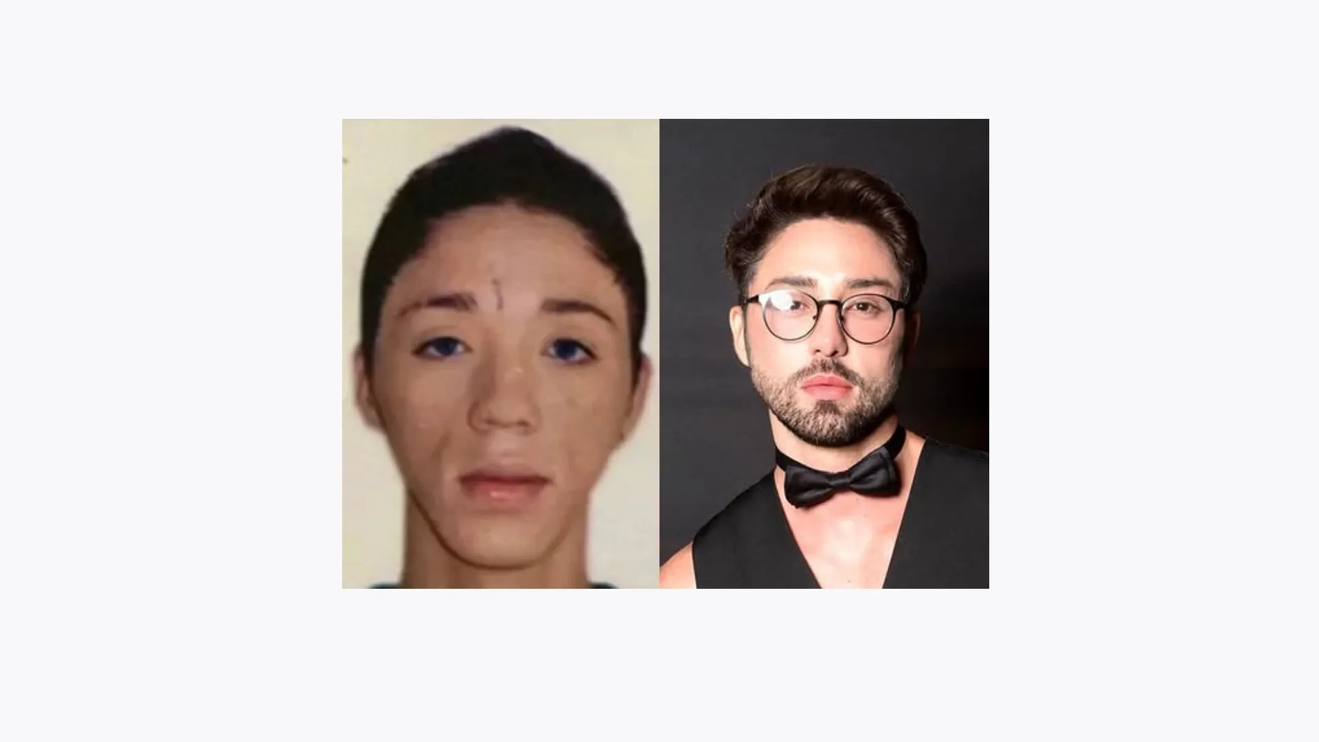 Imagem ilustrativa da imagem Rico Melquíades revela desejo por cirurgia inusitada: "Trocar os pés"